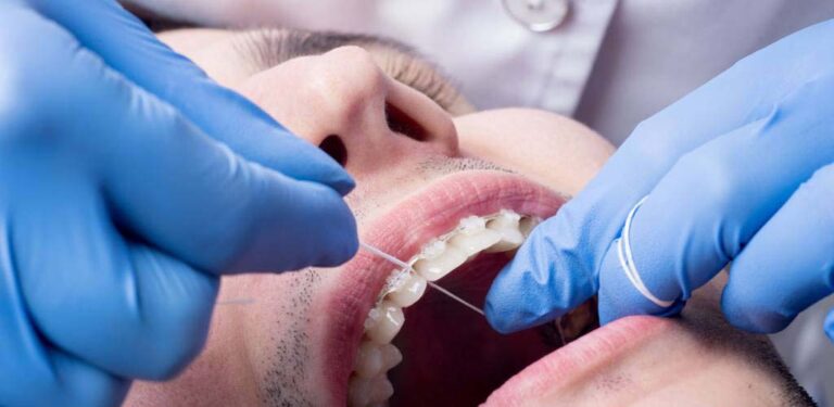 Exploring The Role What Does A Dental Hygienist Do Direct Dental Exploring The Role What Does A Dental Hygienist Do Direct Dental
